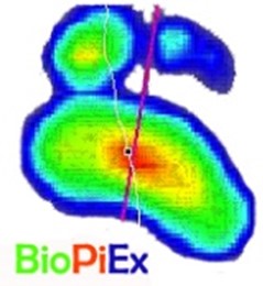 BiomecanicayortopediadelpiedeExtremadura.jpg